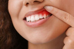 gum disease treatment north salt lake Dr. Will Bates. Serene Dentistry of North Salt Lake. General, Cosmetic, Restorative, Pediatric Family Dentistry Dentist in Salt Lake City UT 84054