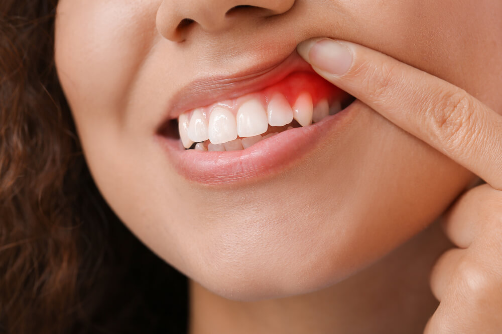gum disease treatment north salt lake Dr. Will Bates. Serene Dentistry of North Salt Lake. General, Cosmetic, Restorative, Pediatric Family Dentistry Dentist in Salt Lake City UT 84054