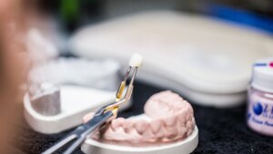 dental bonding near me